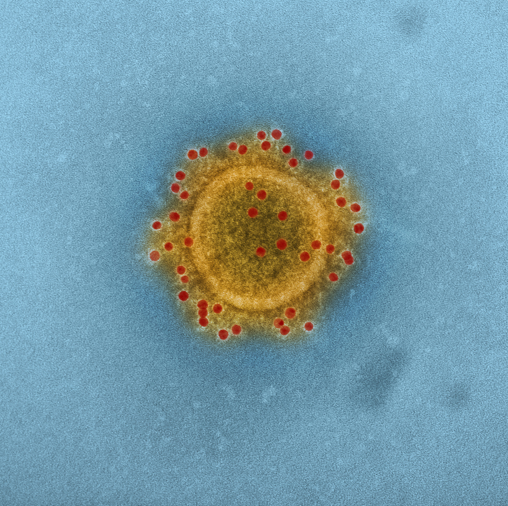 Coronavirus. Image: National Institutes of Health