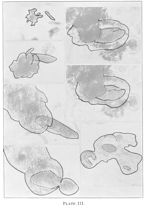 Tracing over a microscope image of a "confused" amoeba surrounded by paramoecia